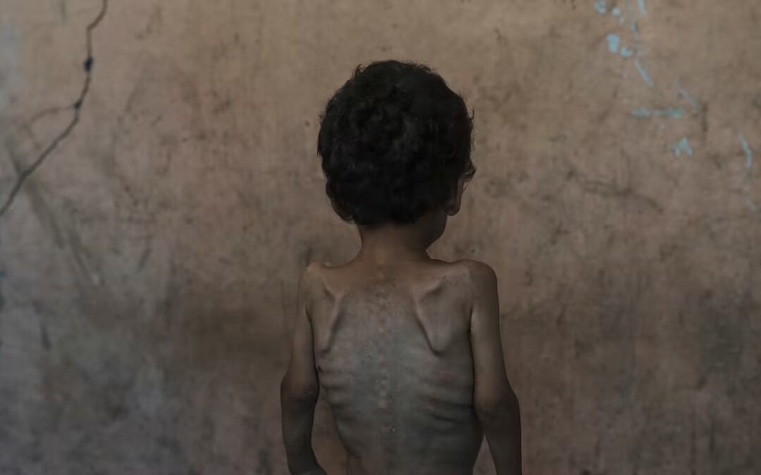 ¿Cuál es la diferencia? Genocidio en Gaza
