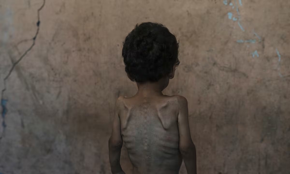 LDM6R4GGVRGN5MJVO6V5BUEPBE.jpg Niño gazati